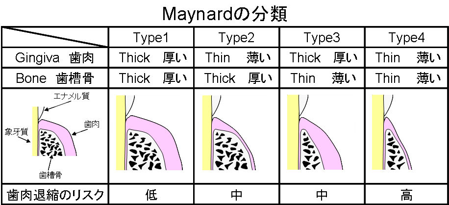 Maynardの分類.jpg