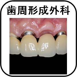 歯周形成外科アイコン.jpg