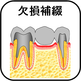 欠損補綴アイコン.jpg