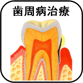 歯周病治療アイコン.jpg