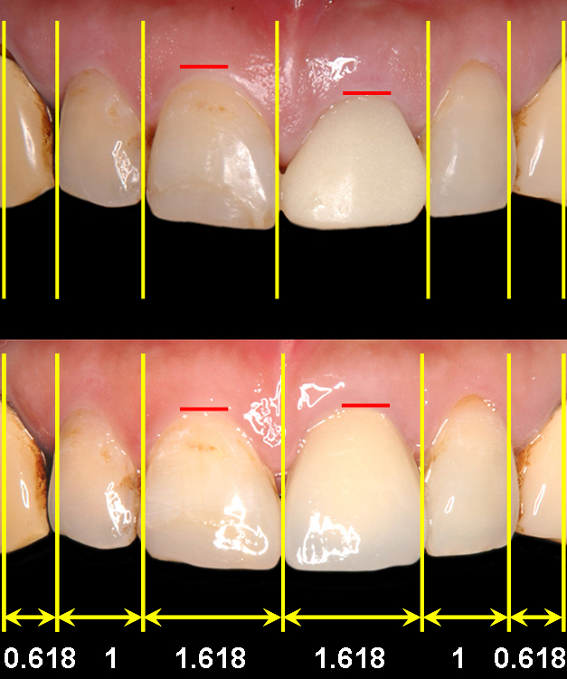 ＭＢ６術前術後２.jpg